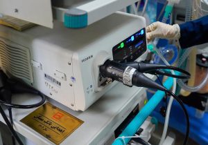 تداوم حمایت‌های بانک مسکن از بهداشت و درمان/ تجهیز بیمارستان فیروزگر به فناوری نوین تشخیصی ریه
